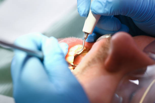Best Emergency Dental Care for Broken or Chipped Teeth in Swede Heaven, WA