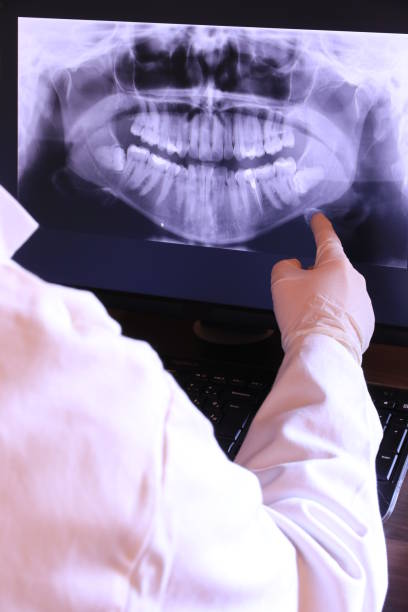 Best Emergency Root Canal Treatment in Swede Heaven, WA
